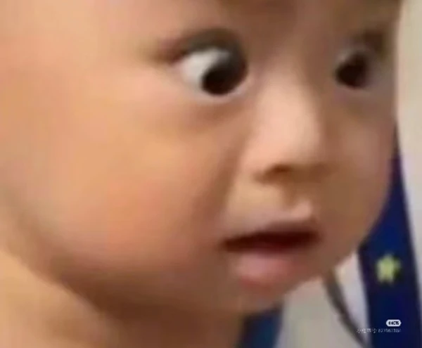 Một cậu bé với mũi to và mũi to meme bất ngờ